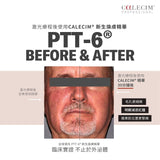 PTT-6® 紅鹿修復精華