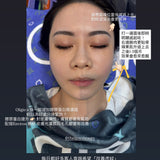 Oligio X 精緻上鏡 + 完美Jawline + 改善虎紋｜送一次 養膚水光基礎護理 (價值 $1699)｜ 九月中開放預約